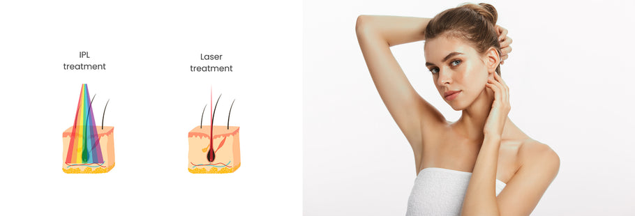 IPL vs. Salon Laser Hair Removal: Which to Choose?