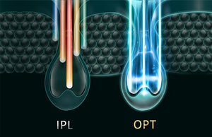 bosidin OPT intense pulsed light